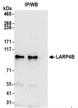 Rabbit anti-LARP4B Antibody, Affinity Purified