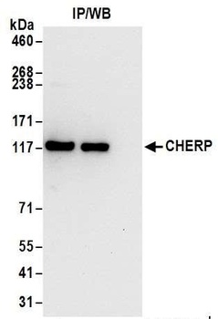 Rabbit anti-CHERP Antibody, Affinity Purified