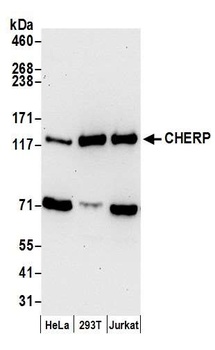 Rabbit anti-CHERP Antibody, Affinity Purified