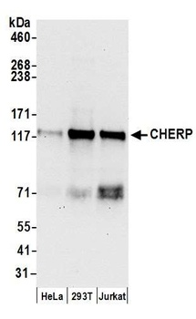 Rabbit anti-CHERP Antibody, Affinity Purified