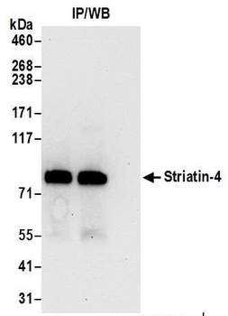 Rabbit anti-Striatin-4 Antibody, Affinity Purified