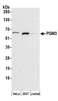 Rabbit anti-PGM3 Antibody, Affinity Purified