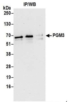 Rabbit anti-PGM3 Antibody, Affinity Purified