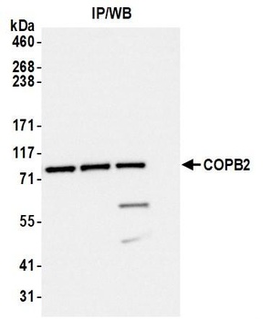 Rabbit anti-COPB2 Antibody, Affinity Purified