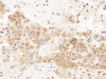 Rabbit anti-ICLN Antibody, Affinity Purified