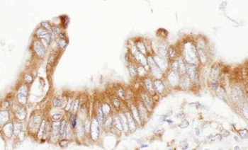 Rabbit anti-ERp5 Antibody, Affinity Purified