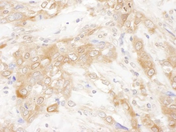 Rabbit anti-CHMP2B Antibody, Affinity Purified