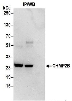 Rabbit anti-CHMP2B Antibody, Affinity Purified