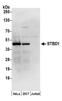 Rabbit anti-STBD1 Antibody, Affinity Purified