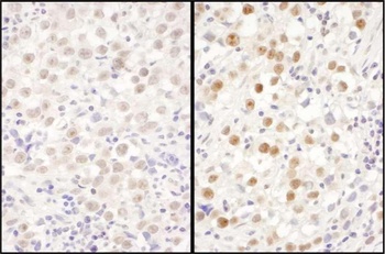 Rabbit anti-LAS1L Antibody, Affinity Purified