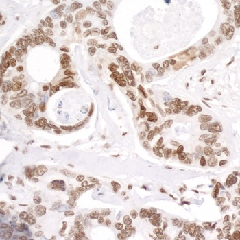 Rabbit anti-RNA Polymerase II, Phospho (S5) Antibody, Affinity Purified