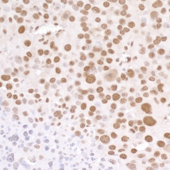 Rabbit anti-RNA Polymerase II, Phospho (S5) Antibody, Affinity Purified