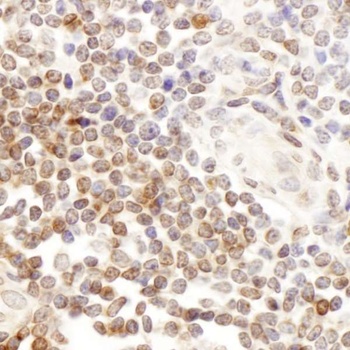 Rabbit anti-CD7 Antibody, Affinity Purified