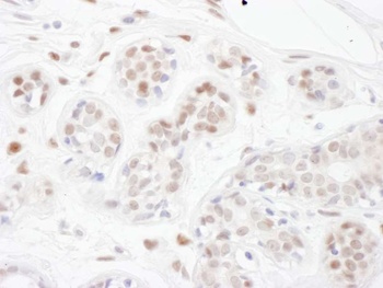 Rabbit anti-PINX1 Antibody, Affinity Purified