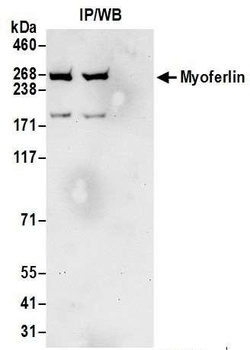 Rabbit anti-Myoferlin Antibody, Affinity Purified
