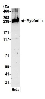 Rabbit anti-Myoferlin Antibody, Affinity Purified