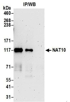 Rabbit anti-NAT10 Antibody, Affinity Purified