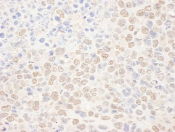 Rabbit anti-NAT10 Antibody, Affinity Purified