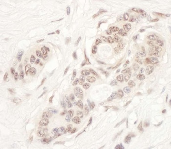 Rabbit anti-NAT10 Antibody, Affinity Purified