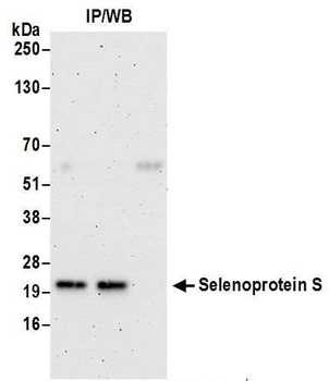 Rabbit anti-Selenoprotein S Antibody, Affinity Purified
