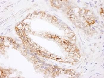 Rabbit anti-MCT1 Antibody, Affinity Purified