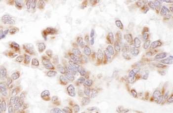Rabbit anti-Presenilin-2 Antibody, Affinity Purified