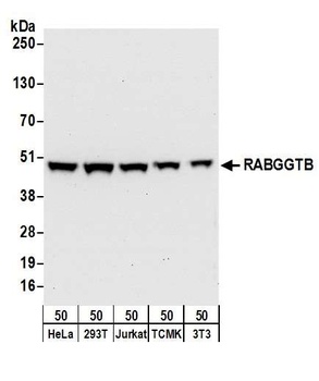Rabbit anti-RABGGTB Antibody, Affinity Purified