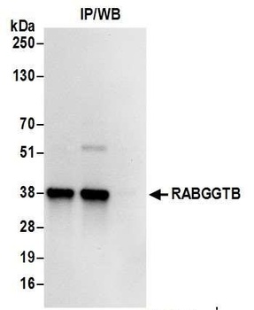 Rabbit anti-RABGGTB Antibody, Affinity Purified