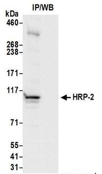 Rabbit anti-HRP-2 Antibody, Affinity Purified