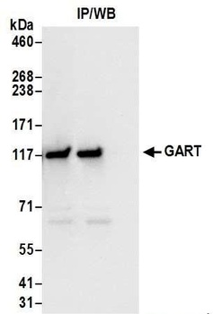Rabbit anti-GART Antibody, Affinity Purified