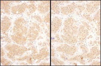 Rabbit anti-GART Antibody, Affinity Purified