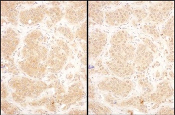 Rabbit anti-GART Antibody, Affinity Purified