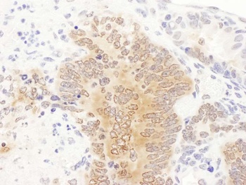 Rabbit anti-GART Antibody, Affinity Purified