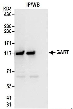 Rabbit anti-GART Antibody, Affinity Purified