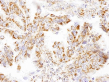 Rabbit anti-DLST Antibody, Affinity Purified