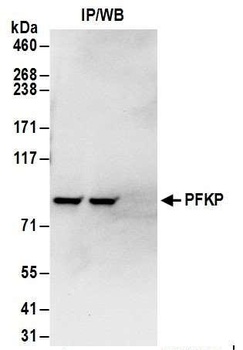 Rabbit anti-PFKP Antibody, Affinity Purified