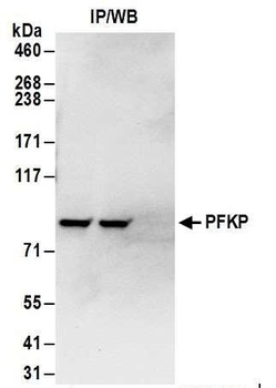 Rabbit anti-PFKP Antibody, Affinity Purified