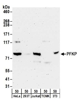 Rabbit anti-PFKP Antibody, Affinity Purified
