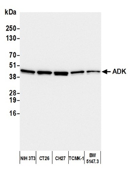 Rabbit anti-ADK Antibody, Affinity Purified