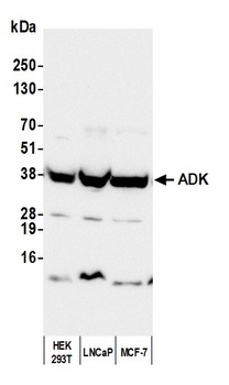 Rabbit anti-ADK Antibody, Affinity Purified