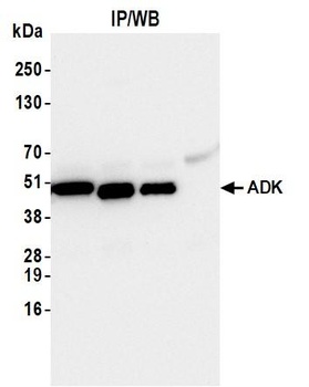 Rabbit anti-ADK Antibody, Affinity Purified