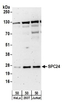 Rabbit anti-SPC24 Antibody, Affinity Purified
