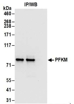 Rabbit anti-PFKM Antibody, Affinity Purified