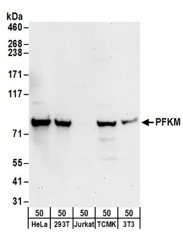 Rabbit anti-PFKM Antibody, Affinity Purified