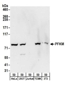 Rabbit anti-PFKM Antibody, Affinity Purified