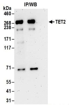 Rabbit anti-TET2 Antibody, Affinity Purified