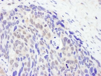 Rabbit anti-TET2 Antibody, Affinity Purified