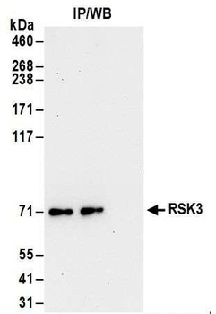 Rabbit anti-RSK3 Antibody, Affinity Purified