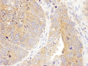 Rabbit anti-Septin 7 Antibody, Affinity Purified