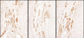 Rabbit anti-Caldesmon Antibody, Affinity Purified